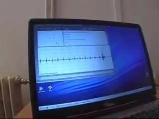 Gyno Clinic Examination of a Cech sweetheart CAROL