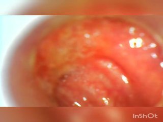 Usb Endoscope 80 Cm Deep Anal Insertion, adult video d2