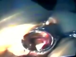 Zhangjiajing медицински сестри taiwanese taiwan nurses(007